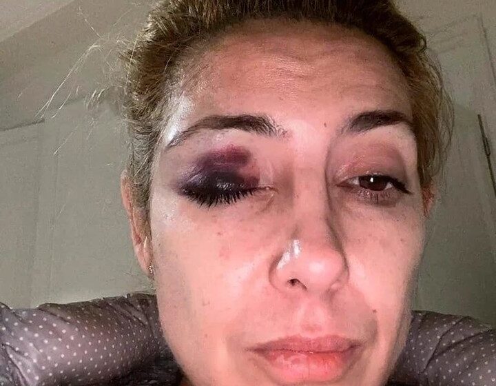  El ocaso del kirchnerismo: Alberto Fernández, procesado por violencia de género